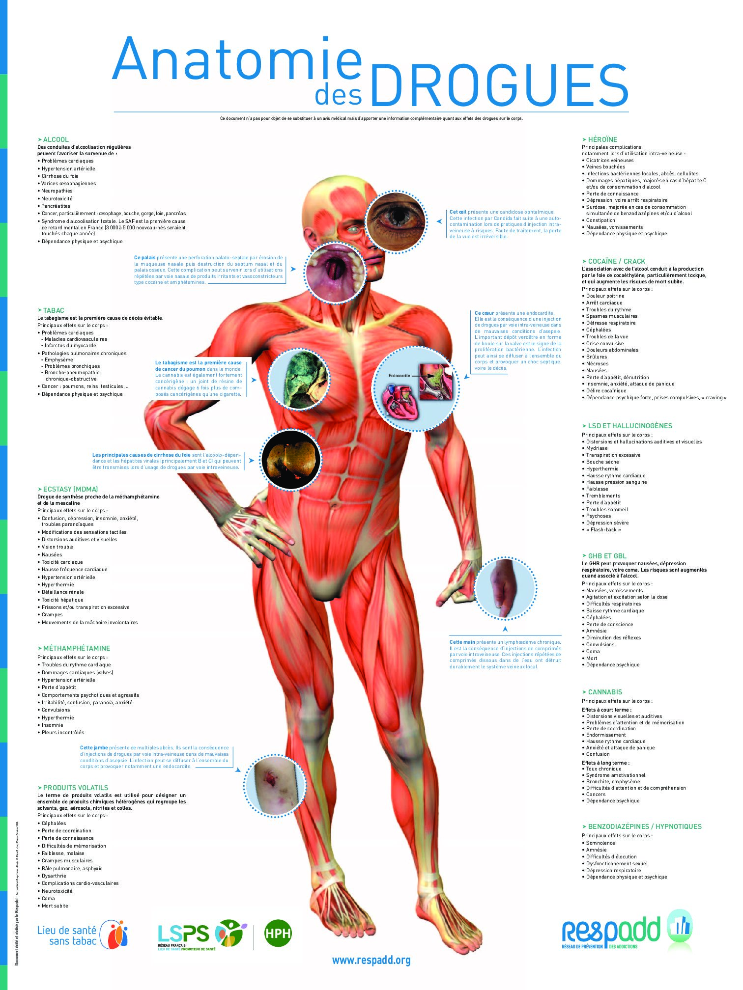 Affiche – Anatomie des Drogues – RESPADD